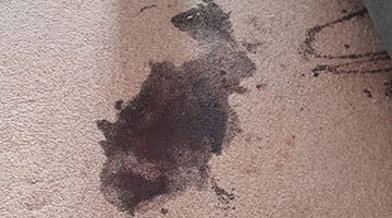 stain removal